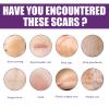 COMETX Adhesive Scar Sheet 40 * 75mm x 4Pcs Adhesive Silicone Scar Sheets Safety Mild Fade Scar Scar Reduction Therapy view 2
