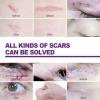 COMETX Adhesive Scar Sheet 40 * 75mm x 4Pcs Adhesive Silicone Scar Sheets Safety Mild Fade Scar Scar Reduction Therapy view 4