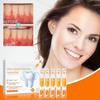 Gum Repair Essence Ampoules, Ampoule Tooth Serum, Teeth Whitening Serum, Gum Instant Repair Gel for Removing Tartar, Teeth Repair, Protect Gums (3box) view 3