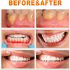 Gum Repair Essence Ampoules, Gum Essence Ampoules, Teeth Whitening Serum, Whitening Dental Disposable Serum, 7pcs/Box (1box) view 3