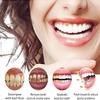 EXQST Sp-5 Toothpaste,Ultra Whitening Probiotic Toothpaste,New Upgrade Ultra Whitening Probiotic Toothpaste view 4