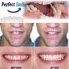 Flipped Warmth 2 Pair Instant Veneers Teeth Dentures Fake Teeth, Cosmetic Tooth Covering Snap Smile Teeth, Clip on Veneers Top And Bottom False Teeth for Men And Women view 2