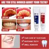 2pcs Sp-5 Toothpaste Sp 5 Teeth whitening WE2C whitening Toothpaste brightening Stain Removal Toothpaste Repairing Toothpaste view 3
