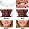 Flipped Warmth 2 Pairs False Teeth Fake Tooth Cosmetic Teeth Veneers Silicone Dentures Cosmetic Veneer Instant Smiling Teeth Matching Set Natural Shade Comfort Fit Dental Prostheses view 4