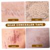 Mipcase Concealer Sticker for Scar Cover up Sticker Patch for Arm Leg Body Skin Scar Concealer view 3
