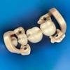 8Pcs Dental Rubber Dam Clamps Dental Distal Premolar Resin Clip Rubber Sheets Barrier Clips for Better Oral and Dental Condition view 4