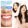 Xumann 10PCS 35% CP Teeth Whitening Gel, 3ML Teeth Bleaching Gel Syringes, Teeth Whitener Gels Refills view 4