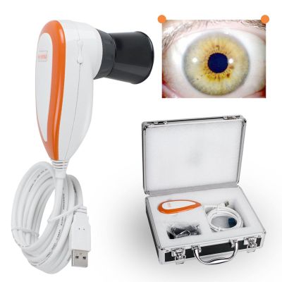 YMAOMAO Iriscope Iridology Camera, 5.0 Mp USB Iris Analyzer Iridology Camera, 5.0m Pixels USB Left/Right Lamp Analyzer/Analysis Iridology Camera with Pro Iris Software