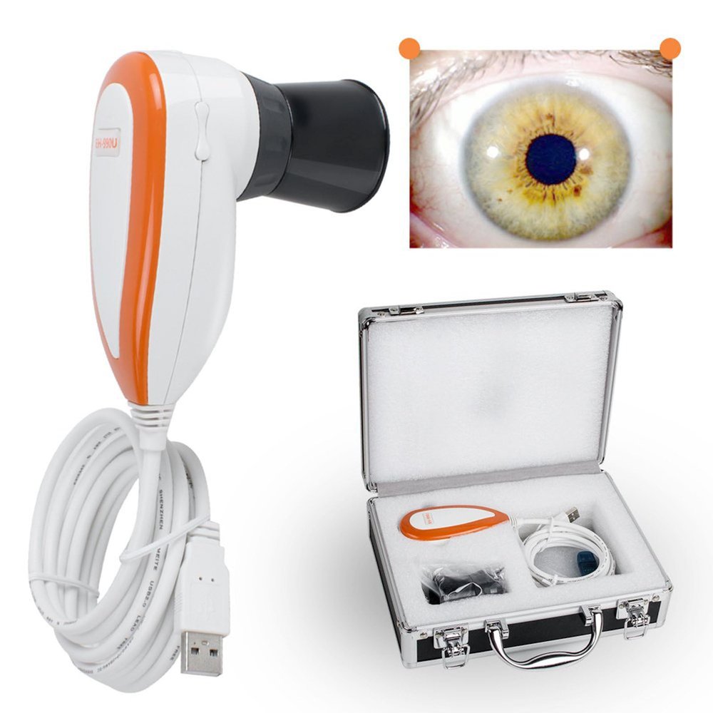 YMAOMAO Iriscope Iridology Camera, 5.0 Mp USB Iris Analyzer Iridology Camera, 5.0m Pixels USB Left/Right Lamp Analyzer/Analysis Iridology Camera with Pro Iris Software