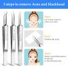 3PCS Blackhead Remover Tweezers and 1PC Ingrown Hair Tweezers, Precision Blackhead Pimple Extractor for Pimple Whitehead Ance, Curved Tip Lash Tweezers for Eyelash Extension view 4
