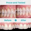 Neslemy Gum Shield Therapy Gel, Neslemy Gum Gel, Gum Shield Therapy Gel and Whitening, Teeth Whitening Essence Pen, Instant Tooth Whitening Pen Sensitive Teeth, Teeth Whitening Pen (2pcs) view 4