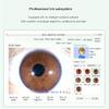 8mp,USB Iriscope Iris Analyzer Iridology,Iriscope Analyzer,Portable Iris Detector,Iris Analyzer Analysis Iridology,for Beauty Salons, Health Clubs A view 3