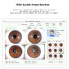 8mp,USB Iriscope Iris Analyzer Iridology,Iriscope Analyzer,Portable Iris Detector,Iris Analyzer Analysis Iridology,for Beauty Salons, Health Clubs A view 4