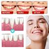 Gum Shield Therapy Gel, 3 Pieces Dentizen Gum Therapy Gel, Teeth Whitening Gum Shield Gel, Teeth Whitening Gel Receding Gum Treatment, Tooth Whitening Pen Teeth Whitening Gel view 4