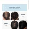 beBloomie Men's Hair Growth Vitamin Supplements Capsules, Clinically Tested for Visibly Thicker Hair and Scalp Coverage, Dermatologist Recommended - 1 Month Supply view 2