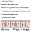 Natural Repair Vagianal Capsules, Detox Repair Capsulas, Firming Repair Natural Capsules,Stay Clear & Fresh (3 Box) view 3