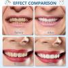 LXURY False Teeth Veneers Top and Bottom Instant Veneers Fake Teeth White Dentures Instant Smile Veneers Cosmetic Teeth Whitening Temporary Prosthesis Teeth with Thermal Beads,01,15PCS view 3