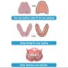 DENTUREWAY DIY Denture Kit with Impression (3 Sets of False Teeth), Partial Denture Solution, White, Small view 4