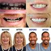 Silicone Dentures Cosmetic Veneer Instant Smiling Teeth Upper and Lower Matching Comfort Fit Dental Prostheses Set for Toothless Quickly Repair Your Teeth and Smile,01,14PCS view 3