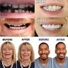 Dentures Cosmetic Veneer False Teeth for Men Women Temporary Prosthesis Teeth Bottom False Teeth Instant Smile Silicone Dental Prostheses for Protecting Teeth Regaining Smile,01,9PCS view 3