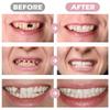 84Pcs False Teeth Dental Complete Acrylic Resin Denture Teeth,3 Sets Halloween Horror Teeth Synthetic Resin Teeth Temporary Crowns for Halloween Makeup Cosplay Costume Party Ornament Supplies(White) view 3