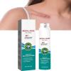Lovilds Advanced Scar Spray, Scar Remove Advanced Scar Spray, Scar Removal Spray, Acne Scar Treatment for Face, Acne Scars and Dark Spaot Remover, for All Types of Scars (1Pcs) view 1