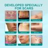 Lovilds Advanced Scar Spray, Scar Remove Advanced Scar Spray, Scar Removal Spray, Acne Scar Treatment for Face, Acne Scars and Dark Spaot Remover, for All Types of Scars (3Pcs) view 4