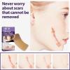 Amagogo Advanced Silicone Treatment Strips view 2