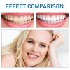1 Pair of Snap-On Dentures Set, Comfortable Silicone False Teeth for Upper & Lower Jaw, Instant Smile Enhancer for Men Women with Bad Teeth, Temporary Veneer False Teeth for Interviews Dates Parties view 4