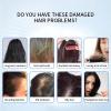 7in1 Hair Skin Analyzer, Skin Care Analyser Machine with 7 Probes and 17in Display, 4 Spectrum Detection and 4 Image Freeze Storage Functions, Adjustable 1J-20J Energy, 360 Detection, for Salon view 3