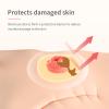 DERAYMI 10PCS 2mm Ostomy Rings, Moldable Hydrocolloid Ostomy Barrier Rings for Stoma Bags, Self-Adhesive, Leak-Proof Stoma Accessories for Colostomy Bags view 4