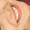 GALPADA 3pcs Diamond Cross Tooth Ornament Metal Tooth Gems Grill Jewelry for Cosplay Costume Props view 4