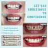 EUPSIIU 2 Pieces False Teeth Dental Complete Acrylic Resin Denture Teeth 2 Set Whole Teeth Synthetic Polymer Denture Tooth Cosplay Costume Ornament Supplies Halloween Makeup Replacement DIY (2 pcs) view 4