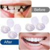 2 Sets False Teeth Set Fake Braces Upper and Lower Jaw, Temporary Dentures Teeth with Mini Tweezers, Clip in Veneers Teeth for Men and Women Instant Confidence Smile view 2