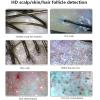 vanenferse Scalp Detector, 11inch HD Scalp Detector Microscope for MultiFunctional Hair Follicle Skin Testing Smart Analysis, 50X 200X Magnification view 2