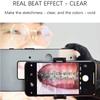 Bceer Dental Photography Equipment Holder Mobile Flash Light LED Oral Filling Light For Dentistry view 2