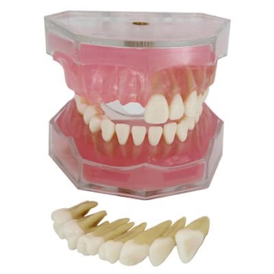 PLABNK Soft Gingival Tooth Model, Fully Disassembled Learning Practice Tooth Extraction Model,Dental Model Soft Gums,Natural