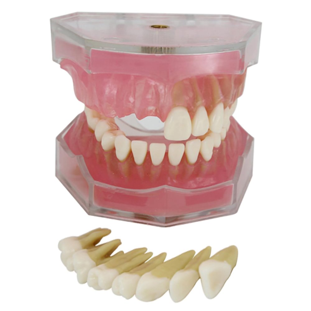 PLABNK Soft Gingival Tooth Model, Fully Disassembled Learning Practice Tooth Extraction Model,Dental Model Soft Gums,Natural