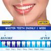 MUNSKT Teeth Whitening Strips,Tooth Whitening Kits, Teeth Whitener, Tooth Whitening Kits, 28 Pcs Teeth Whitening Strips,Teeth Whitener Kits Tooth Whitening Kits Enamel Safe Non-Sensitive at Home view 2