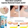 Lumpfree Lipoma Removal Cream,Lump Free Lipoma Removal Ointment Humans for Fatty Tissue, Removal Relieving Subcutaneous Lumps (2 Pcs) view 2