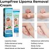 Lumpfree Lipoma Removal Cream,Lump Free Lipoma Removal Ointment Humans for Fatty Tissue, Removal Relieving Subcutaneous Lumps (2 Pcs) view 3