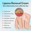 Lumpfree Lipoma Removal Cream,Lump Free Lipoma Removal Ointment Humans for Fatty Tissue, Removal Relieving Subcutaneous Lumps (2 Pcs) view 4