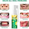 Propolis Oral Health Spray, Propolis Oral Spray, Fresh Breath, Deep Cleaning, Clean Teeth Stains and Tartar, Solve All Oral Problems (2Pcs) view 4