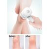 Electric Callus Remover for Feet with Vacuum, Electric Vacuum Foot Grinder Pedicure Device, Rechargeable Hard Skin Remover Foot File Pedicure Tools for Dead Skin,B (A) (A) view 4