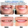 1 Pair Comfort Fit Flex Cosmetic Teeth Clip on Veneers Top and Bottom Set, Temporary Dentures Silicone for Men and Women, Protect Your Teeth and Regain Confident Smile view 3