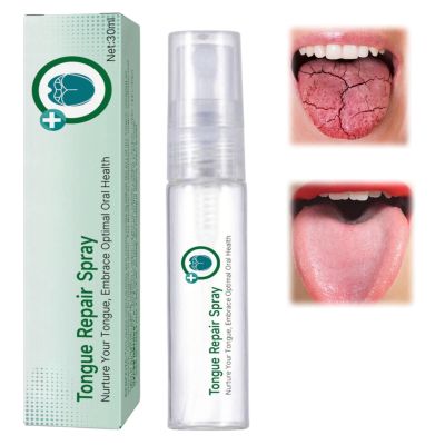 Tongue Repair Spray,Moisturizing Dry Mouth Spray,Fissured Tongue Relief Spray,Instant Dry Mouth Relief,Breath Freshener Spray for Tongue Relief,Tongue Relief Treatment,for White Coating/Bad Breath