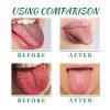 Tongue Repair Spray,Moisturizing Dry Mouth Spray,Fissured Tongue Relief Spray,Instant Dry Mouth Relief,Breath Freshener Spray for Tongue Relief,Tongue Relief Treatment,for White Coating/Bad Breath view 2