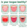 Tongue Repair Spray,Moisturizing Dry Mouth Spray,Fissured Tongue Relief Spray,Instant Dry Mouth Relief,Breath Freshener Spray for Tongue Relief,Tongue Relief Treatment,for White Coating/Bad Breath view 4
