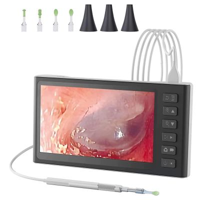 XINGLUOY Digital Otoscope with 7 Inch IPS Screen, 3.9mm Ear Wax Removal Tool Camera with 6 LED Lights, Visual Ear Camera and Wax Remover, Supports Photo Snap and Video Recording