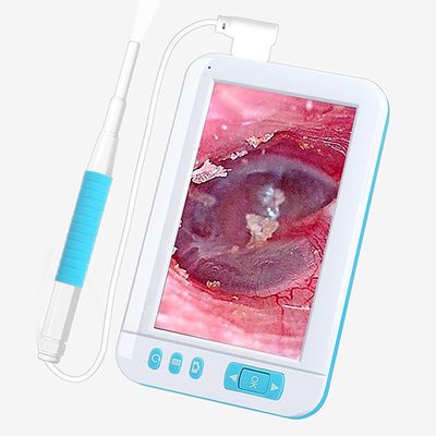 XINGLUOY Portable USB Digital Otoscope Camera, Plug and Play, HD 1080P 3.9MM Len Ear Cleaner with 4.3" IPS Screen and 6 LED Lights and Bracket, Ear Wax Removal Tool